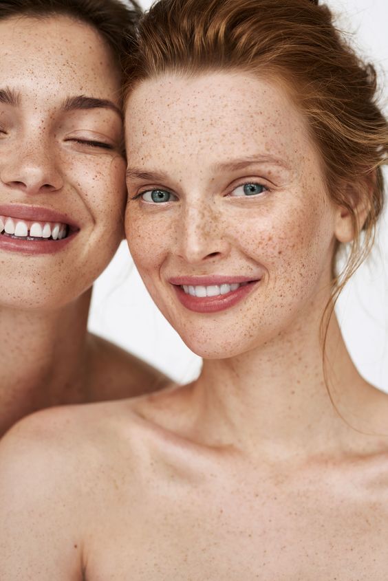 Two women with freckles smiling and looking at the camera.