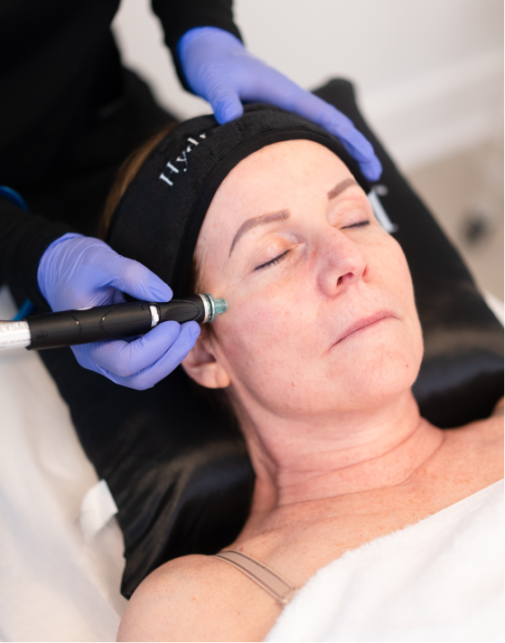 Picture of a women getting Hydrafacial Platinum