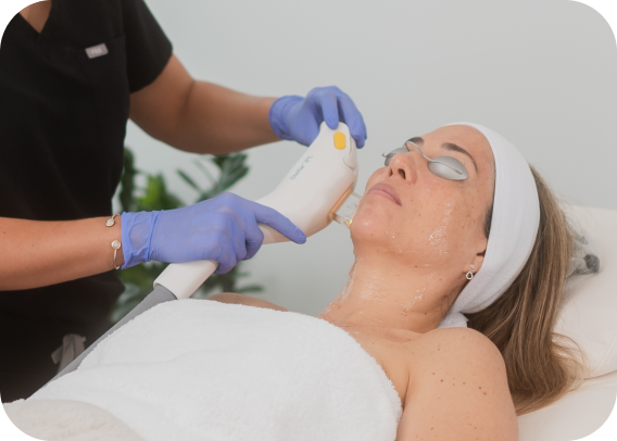 Picture of a woman getting IPL Facial