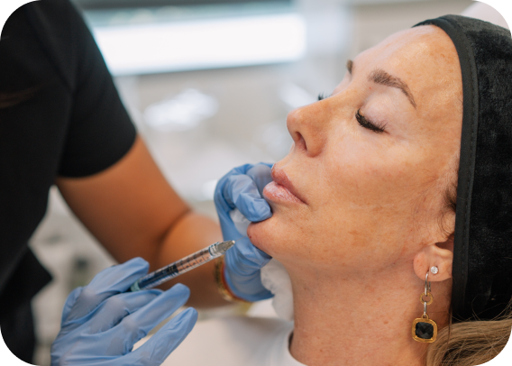 Woman receiving a cosmetic Dermal Fillers injection during restylane treatment